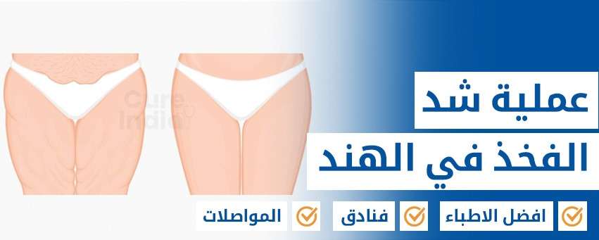 رفع الفخذ